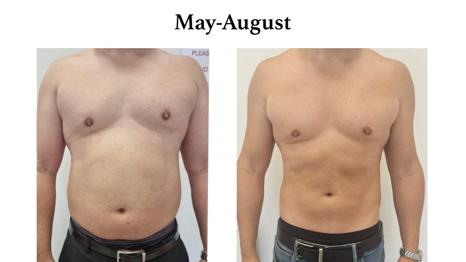 Weight Loss Treatment